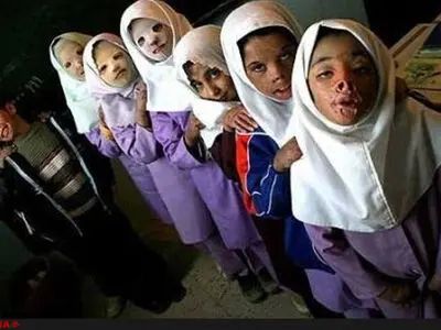 وزارت بهداشت: هزینه درمان دانش‌آموزان درودزن را فقط در بیمارستان دولتی می‌پردازیم/مجلس: دولت موظف به پرداخت هزینه در بیمارستان‌های خصوصی یا اعزام به خارج از کشور است