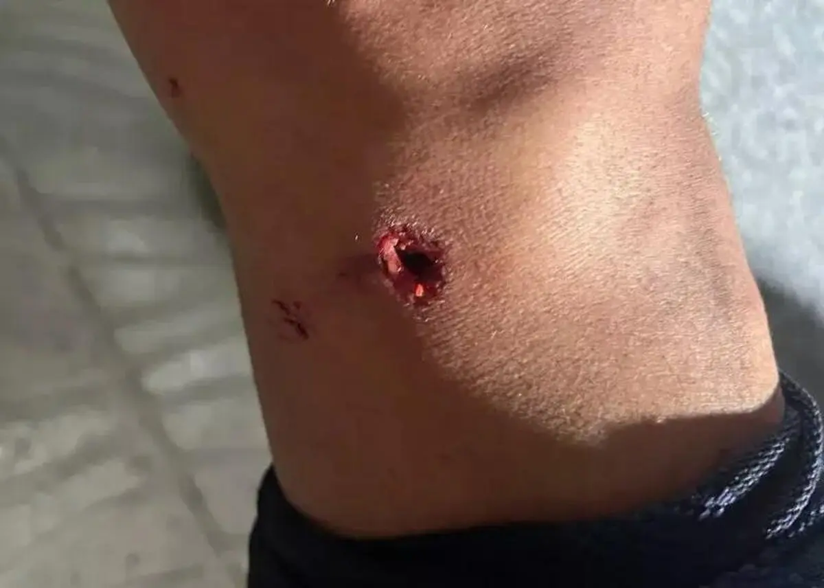 اعتراض آلومینیوم اراک به نحوه قضاوت دیدار با فجرسپاسی با انتشار تصویر مصدومیت جرجانی