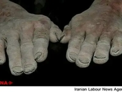 داستان‌هایی از دستان پینه بسته و صورت‌های سوخته