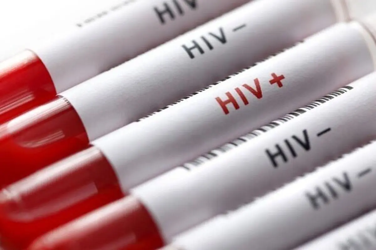 سر و کله ویروس HIV از کجا پیدا شد؟/ نخستین مبتلا به ایدز چه کسی بود؟/ راه‌های انتقال ایدز