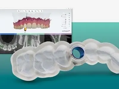 از تجهیزات دندانپزشکی دیجیتال تا اسکنر مدیت و لابراتواری