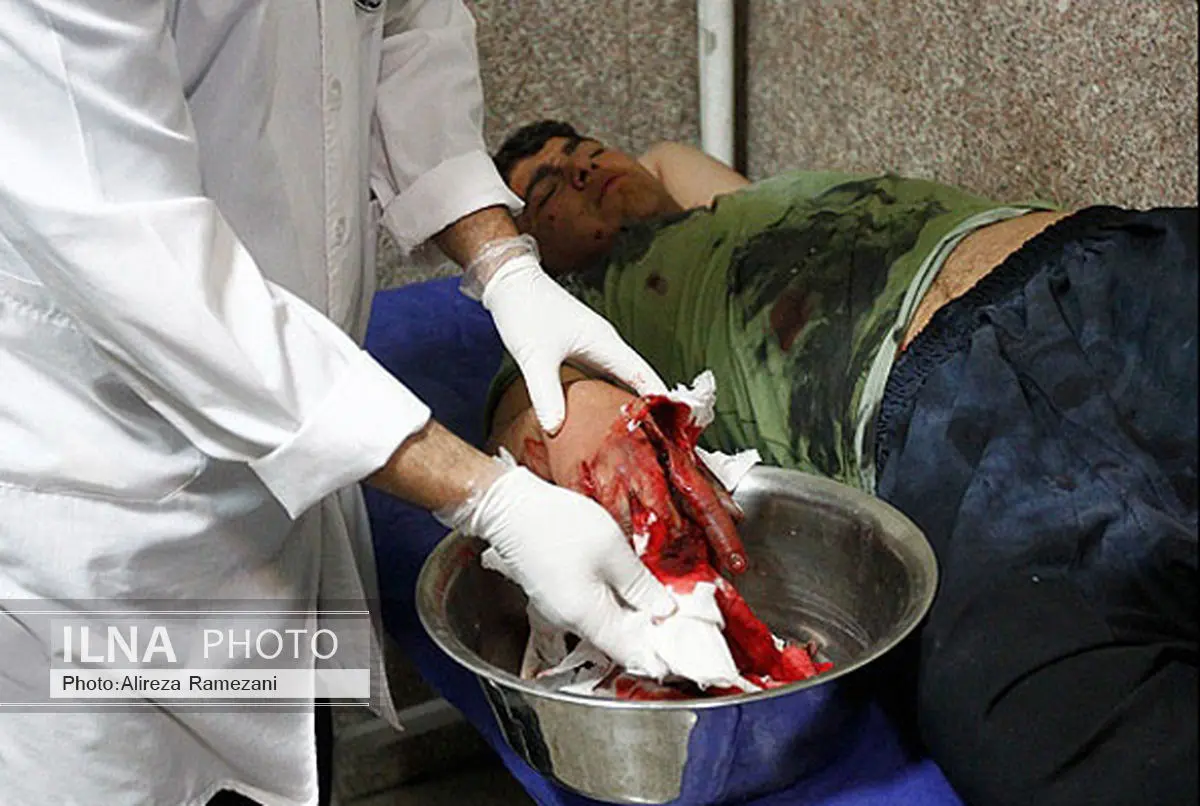 17 مصدوم چهارشنبه سوری امسال در کرمانشاه