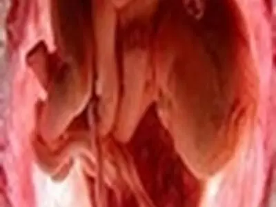 ذخیره‌سازی ۴۰۰ نمونه، در بانک خون بند ناف استان البرز