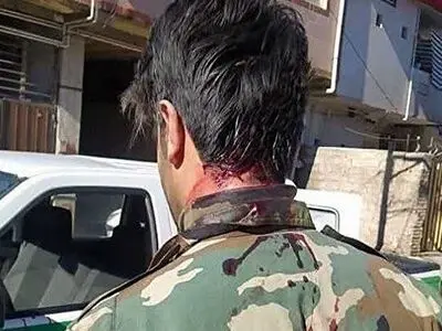شلیک قاچاقچیان چوب به حافظان منابع طبیعی در شهرستان نور/ ۲ نگهبان جنگلی مصدوم شدند