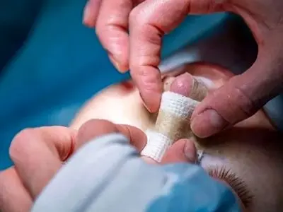 جراحی بینی در شیراز با پزشک 24