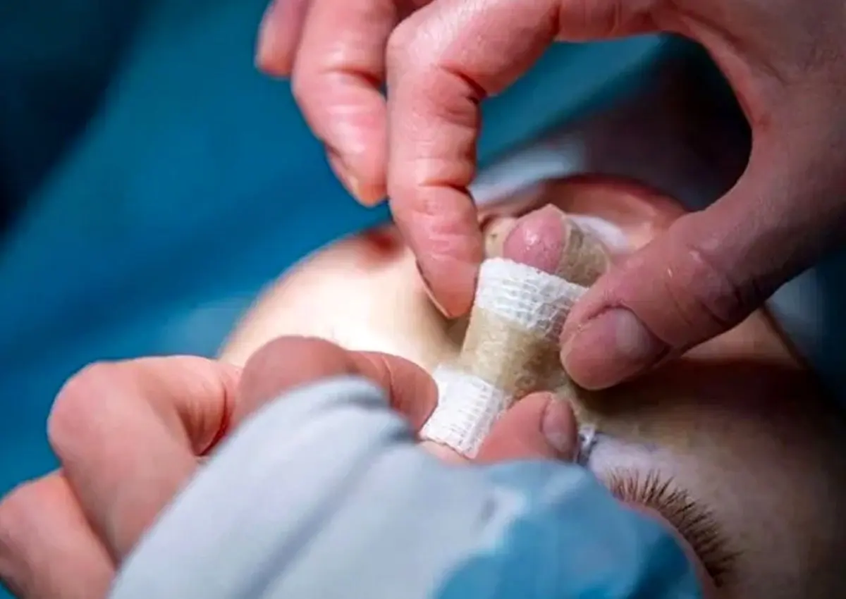 جراحی بینی در شیراز با پزشک 24