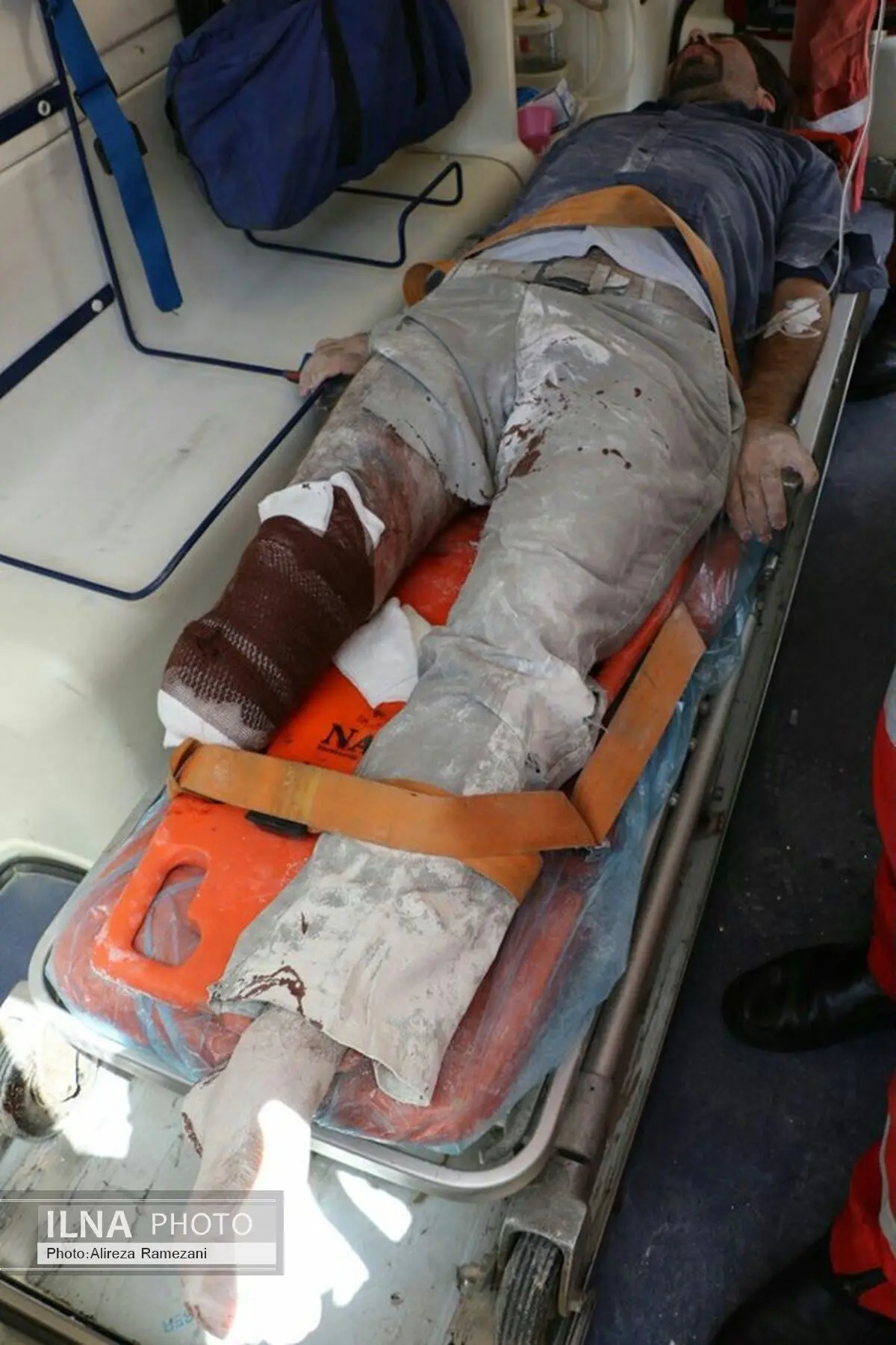 پای راست کارگر مشهدی در دستگاه اسکرو قطع شد