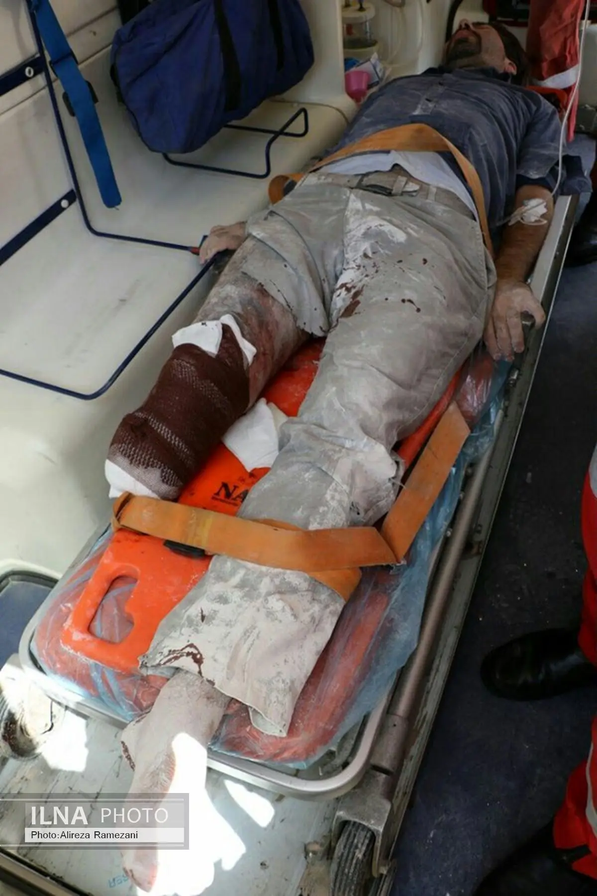 پای راست کارگر مشهدی در دستگاه اسکرو قطع شد