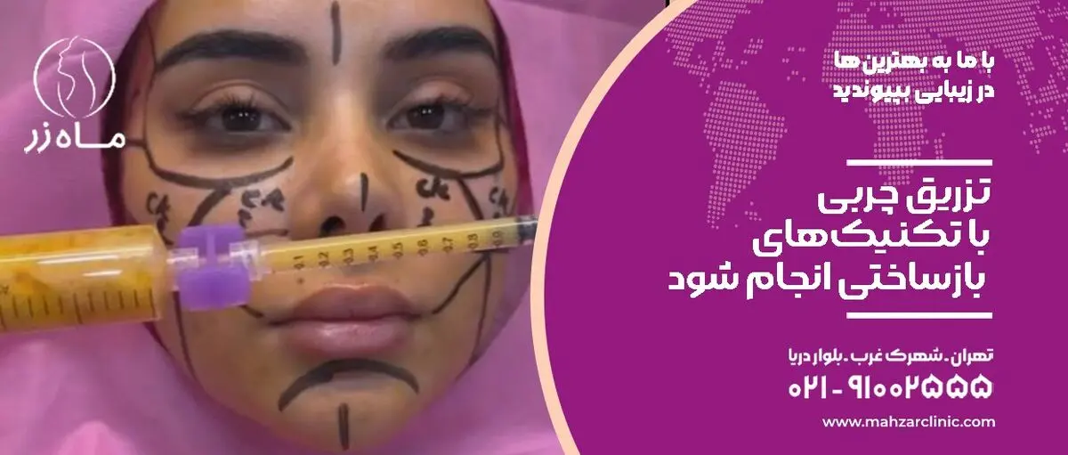 تزریق چربی را انجام ندهید!
