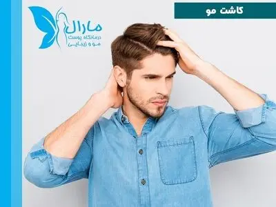 جدیدترین روش کاشت مو و ابرو در کلینیک مارال