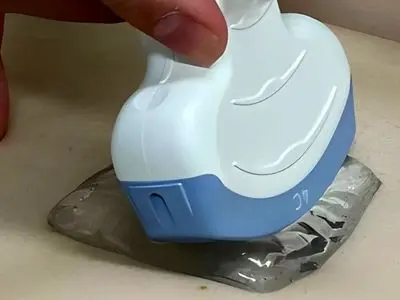 پایان ژل‌های سرد سونوگرافی | نوآوری ژاپنی‌ها تجربه معاینات بارداری را راحت‌تر می‌کند