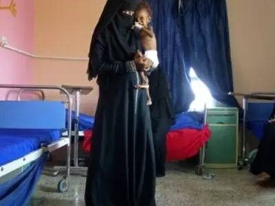 هشدار سازمان ملل نسبت به وقوع فاجعه انسانی بزرگ در یمن