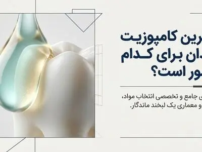 بهترین کامپوزیت دندان برای کدام کشور است؟