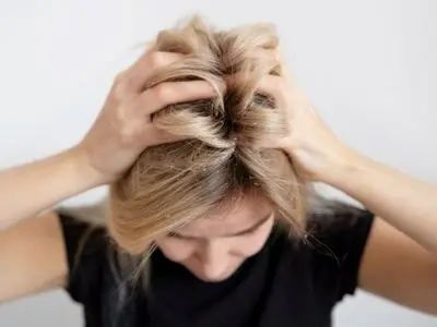 با رعایت این نکات شوره سر را شکست دهید