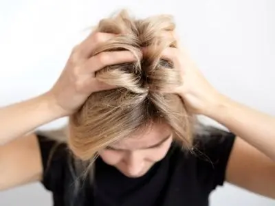 با رعایت این نکات شوره سر را شکست دهید