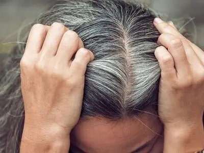آیا استرس واقعا عامل سفیدشدن مو است؟