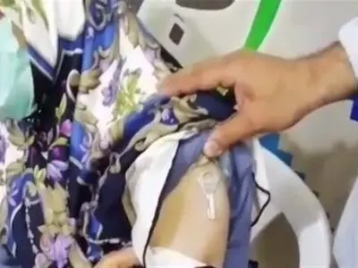 غدد و ترشحات پوستی عامل چسبندگی اشیاء به پوست است/ جریان‌هایی به دنبال واکسن گریزی هستند
