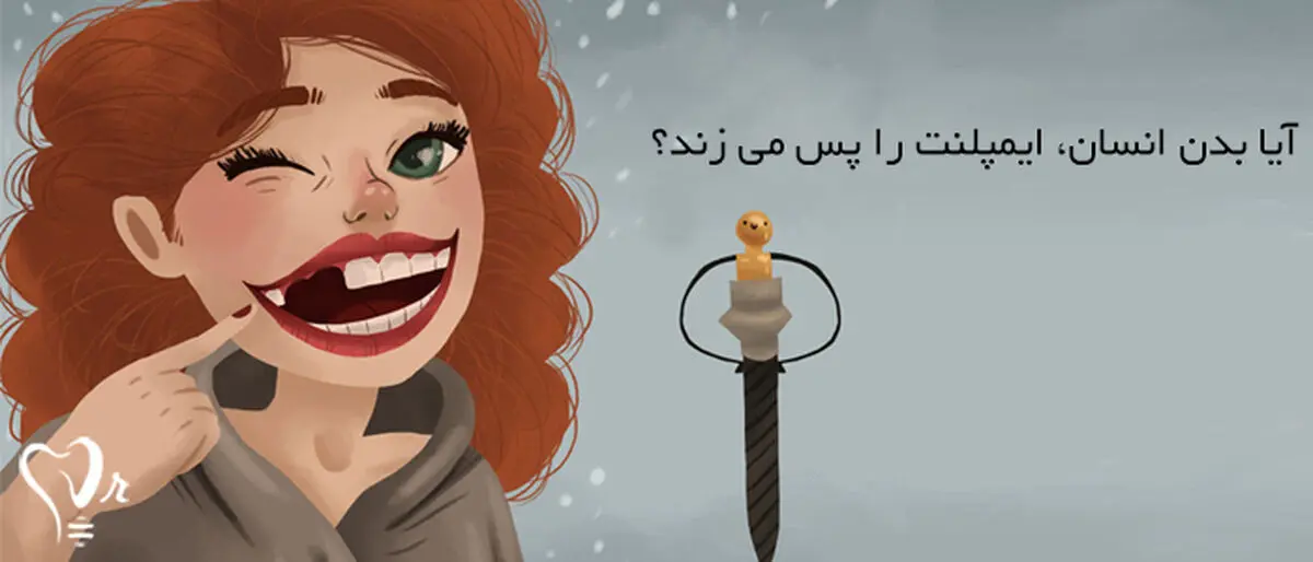 آیا واقعا بدن انسان، ایمپلنت را پس می‌زند؟