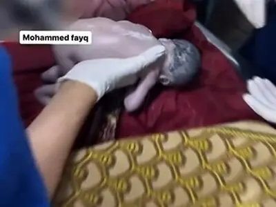 نجات جنینی که مادرش در حمله اسرائیل به شهادت رسیده بود + فیلم