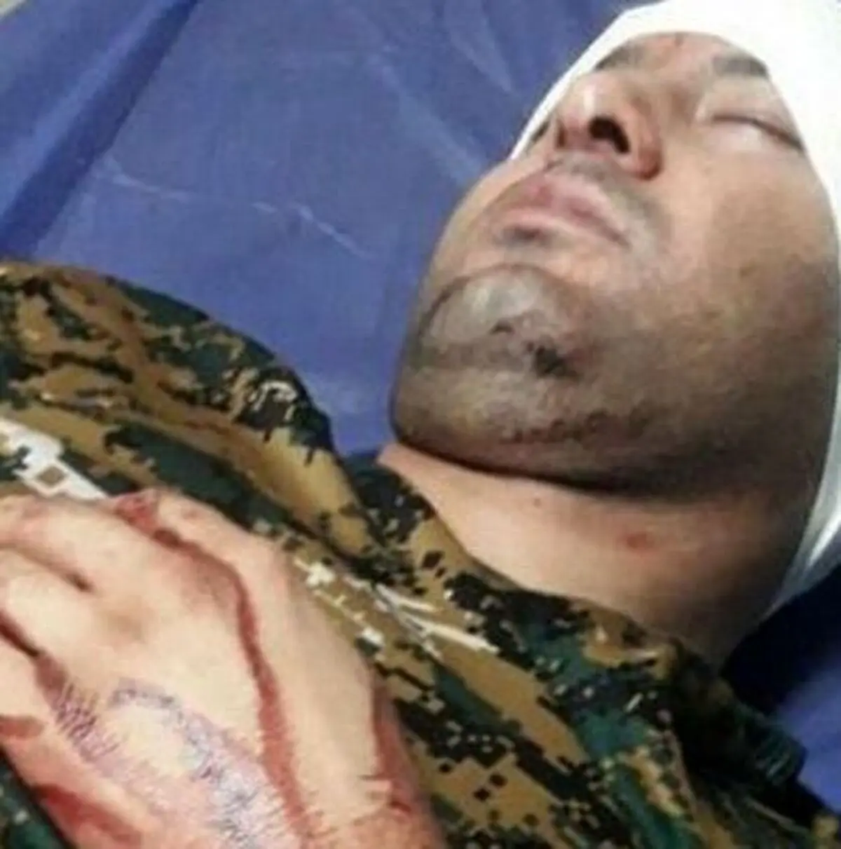مجروح شدن فعال محیط زیست با سلاح سرد/ ارجاع موضوع به شورای تامین دشتستان