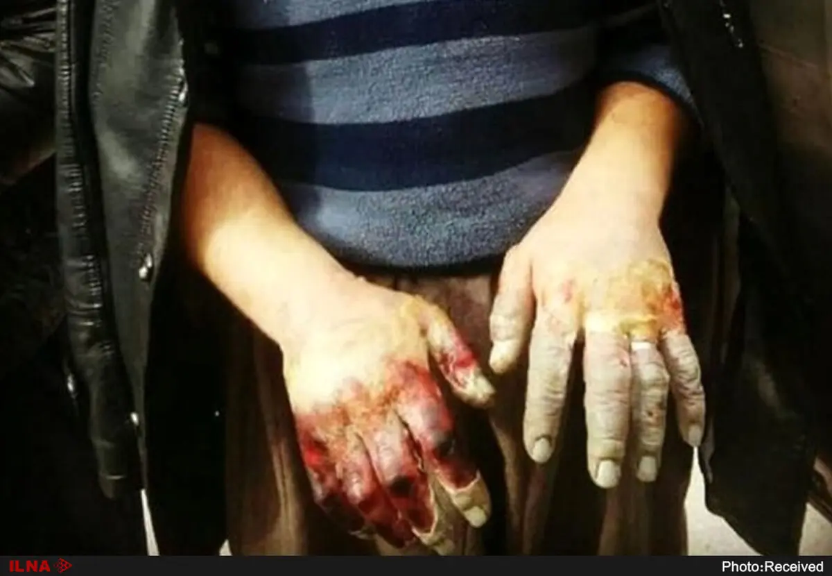 کوه‌های مریوان در انتظار دست‌ها و پاهای کولبران/ یک کولبر با دستان یخ‌زده چه می‌تواند بکند؟
