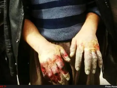 کوه‌های مریوان در انتظار دست‌ها و پاهای کولبران/ یک کولبر با دستان یخ‌زده چه می‌تواند بکند؟