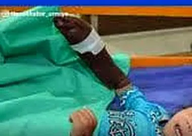 قطع دست یک کودک ۵ساله در محل کار والدین، سردخانه‌ای در اشنویه 