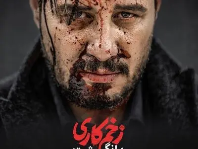 آغاز تصویربرداری فصل دوم «زخم کاری»