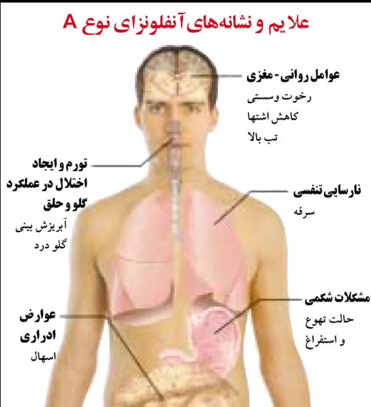 آنفولانزا بیماری حاد و شایع در فصل سرماست