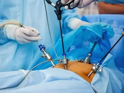 جراحی سرطان معده به روش نوین در بیمارستان شهید جلیل یاسوج انجام شد