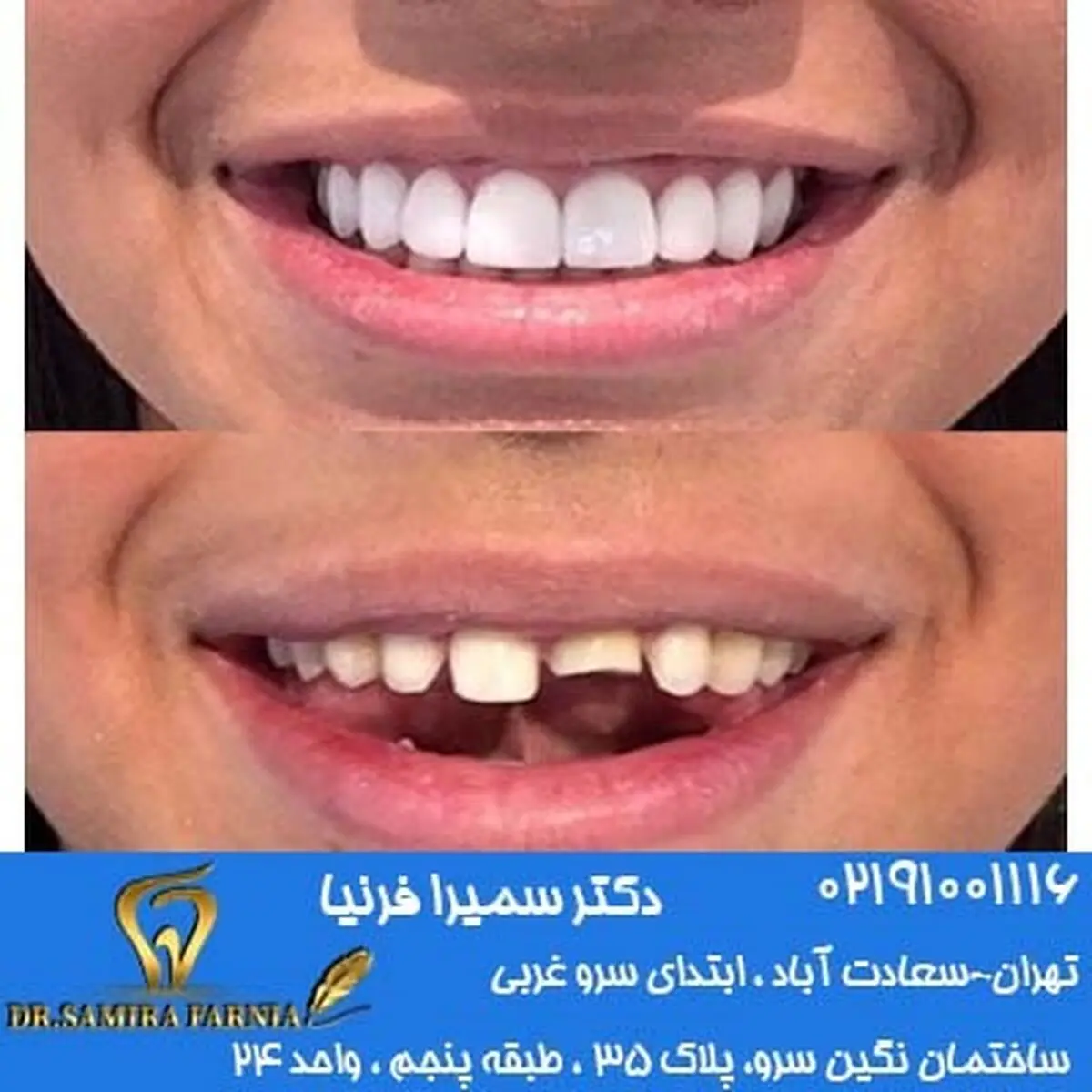 بهترین کلینیک دندانپزشکی سعادت آباد