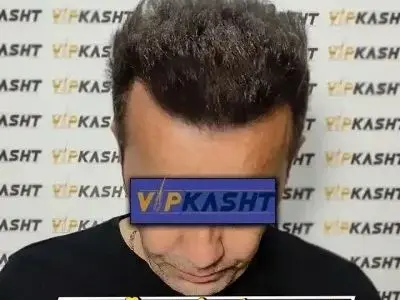 asdasd