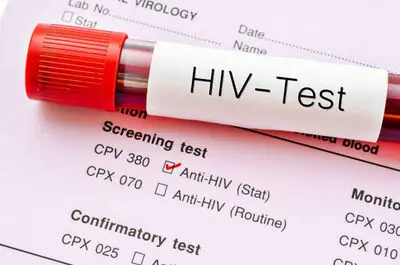 هشدار درباره تغییر الگوی انتقال HIV/ انتقال جنسی در صدر موارد جدید