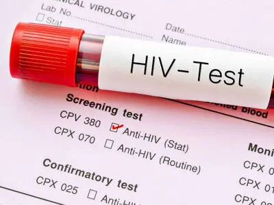 هشدار درباره تغییر الگوی انتقال HIV/ انتقال جنسی در صدر موارد جدید