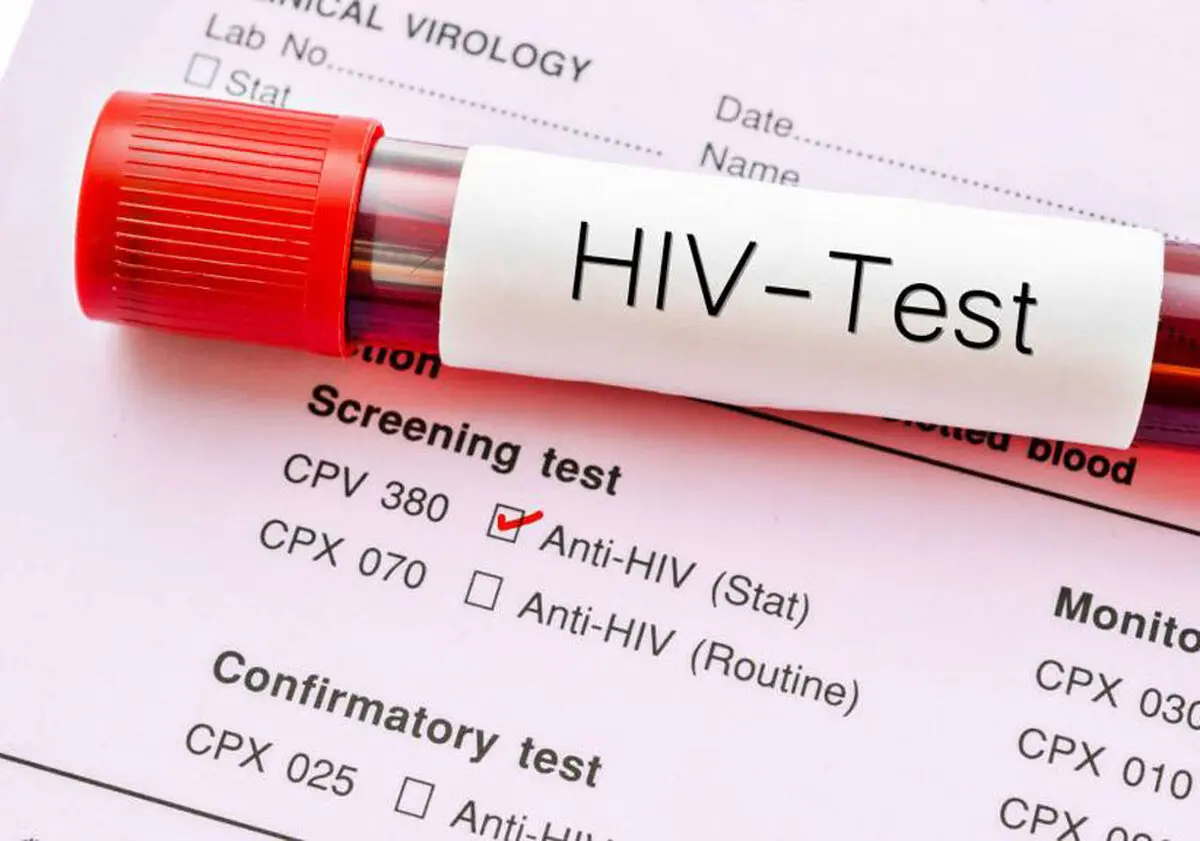هشدار درباره تغییر الگوی انتقال HIV/ انتقال جنسی در صدر موارد جدید