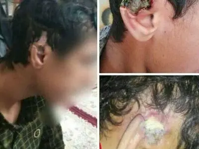اقدام هولناک یک مربی کشتی در نقده / شکستن گوش کشتی‌گیران نوجوان با سکه