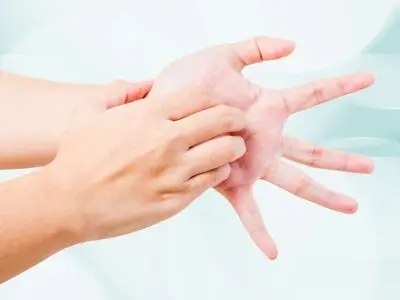 خارش کف دست، خبر از پول می‌دهد یا بیماری؟