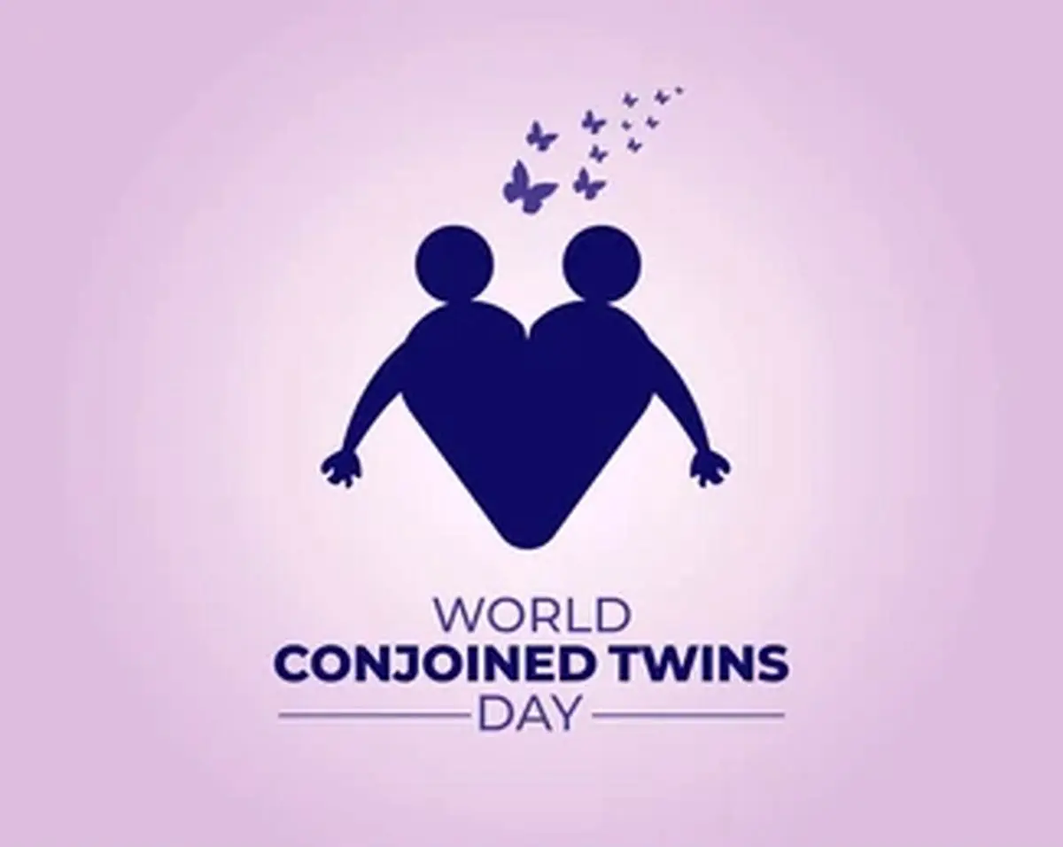۲۴ نوامبر روز جهانی دوقلوهای‌ به هم چسبیده است