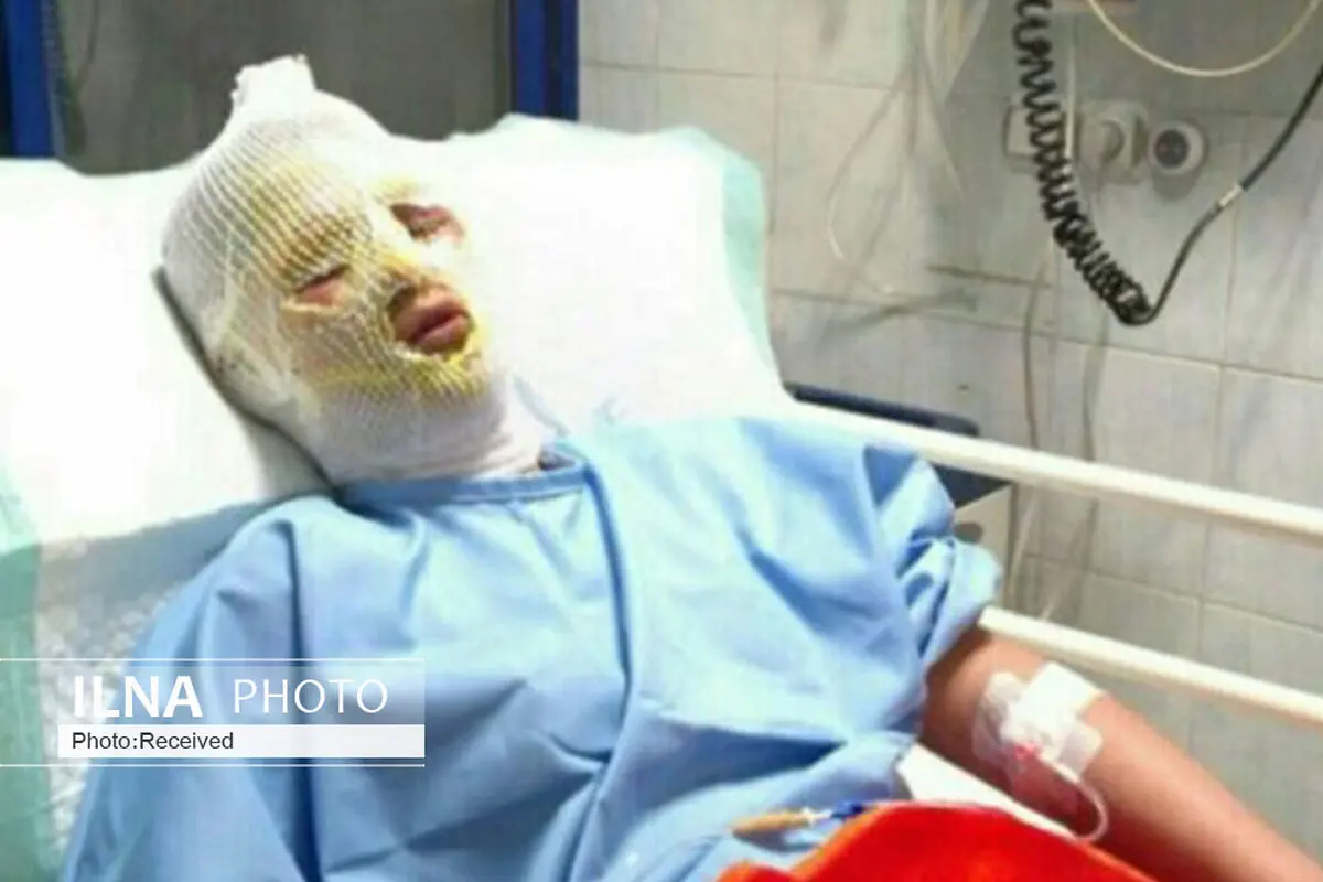  ۸۰ مصدوم بر اثر حوادث چهارشنبه آخر سال در قزوین