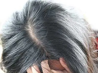چرا موهایتان زودتر از دیگران سفید می شود؟