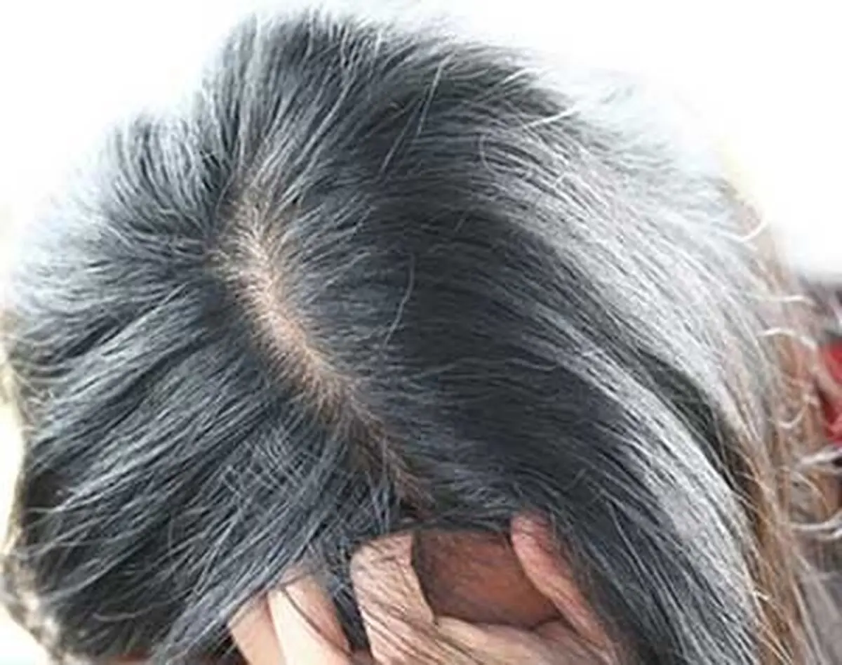چرا موهایتان زودتر از دیگران سفید می شود؟
