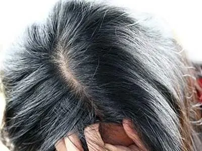 چرا موهایتان زودتر از دیگران سفید می شود؟