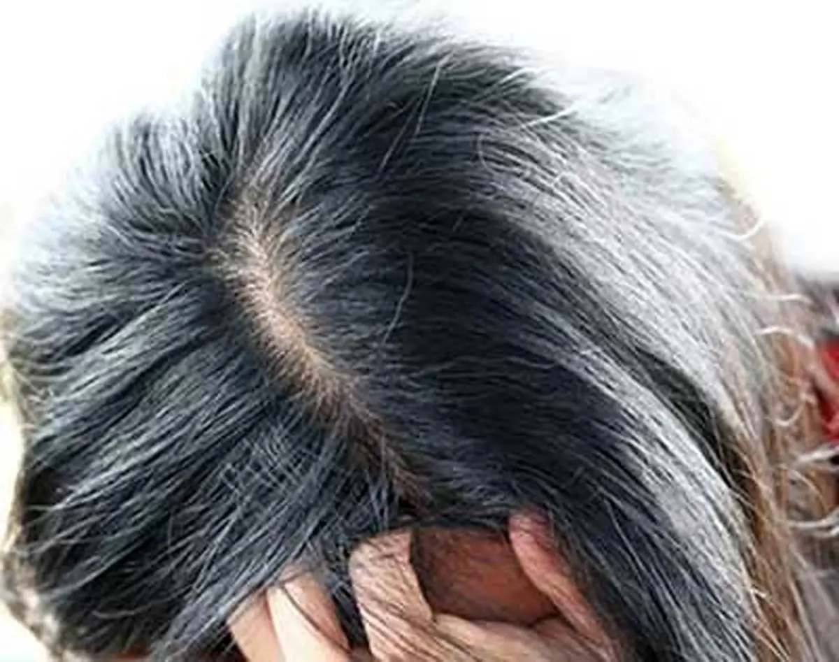 چرا موهایتان زودتر از دیگران سفید می شود؟