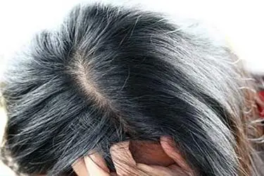 چرا موهایتان زودتر از دیگران سفید می شود؟