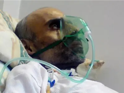حدود ۶۷ هزار جانباز شیمیایی در کشور زندگی می‌کنند