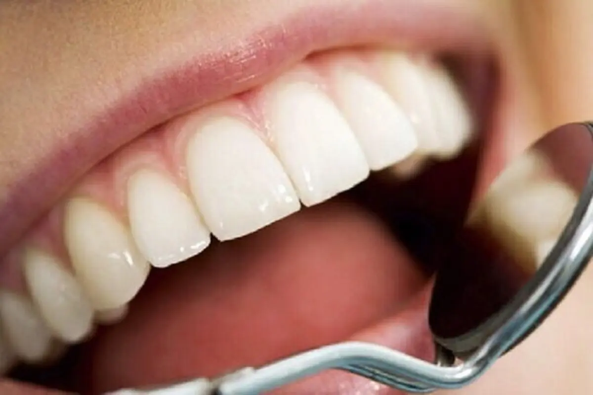 افزایش شیوع سرطان دهان با استعمال دخانیات