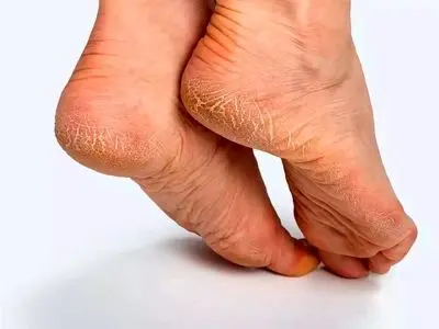 asdasd