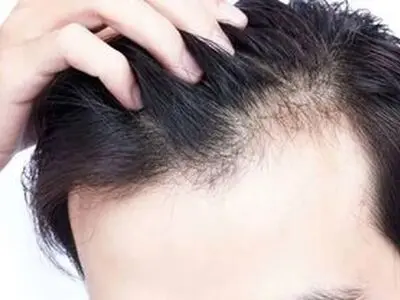 راهکارهای طب ایرانی برای تقویت مو