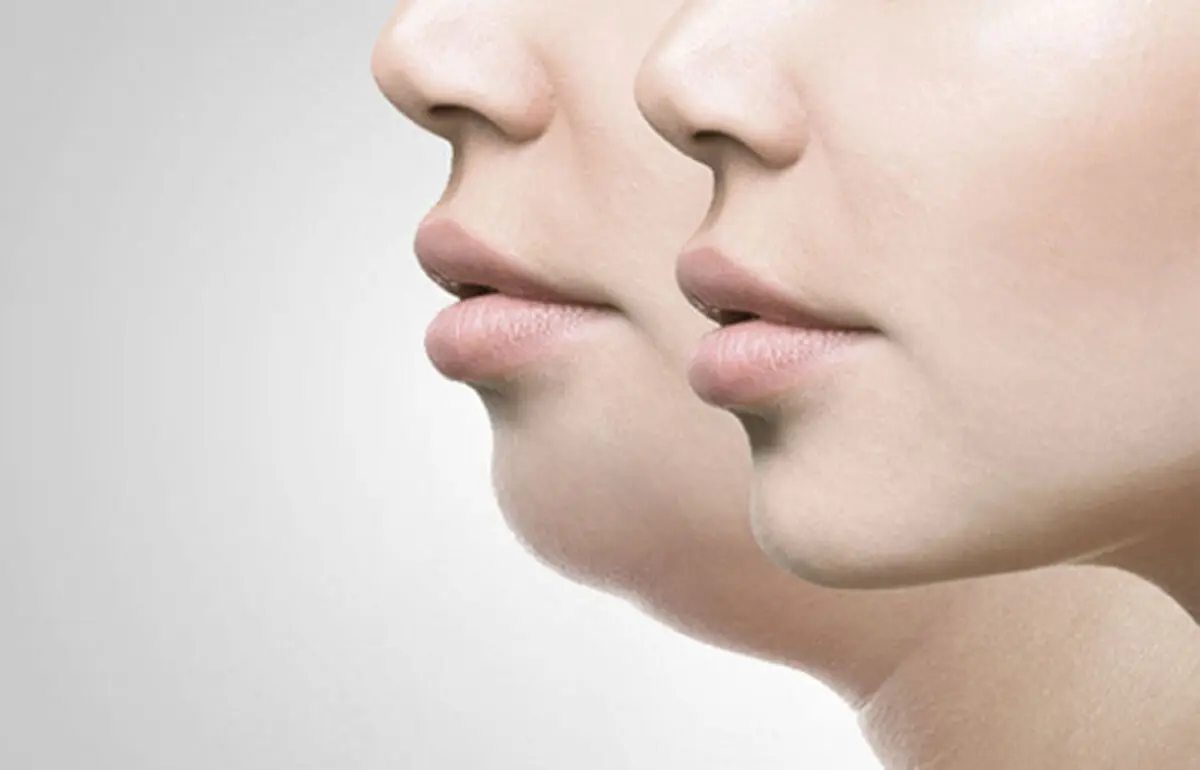 چگونه با ورزش از شر غبغب زیر گلو خلاص شویم؟
