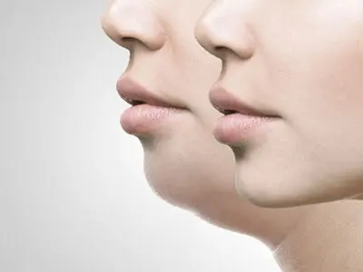 چگونه با ورزش از شر غبغب زیر گلو خلاص شویم؟